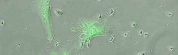 Una investigación de la UMU demuestra que las células madre mesenquimales modificadas con un localizador terapéutico logran frenar ataques inmunológicos letales