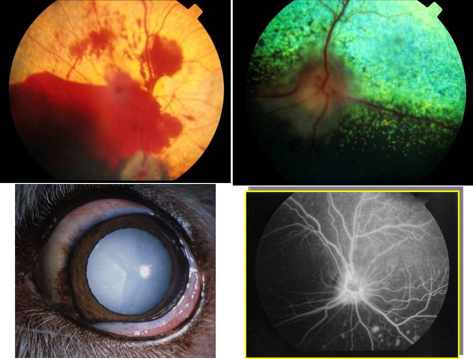 Patologías oculares