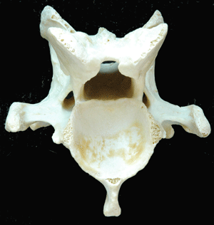 vertebra-cervical-caballo.gif