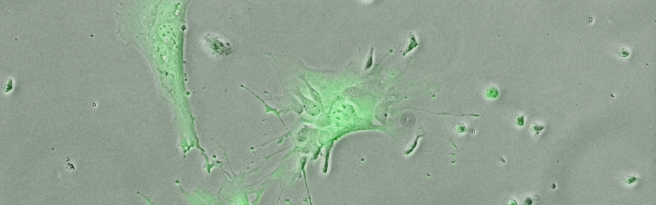 Células madre con 'gps' para frenar ataques inmunológicos