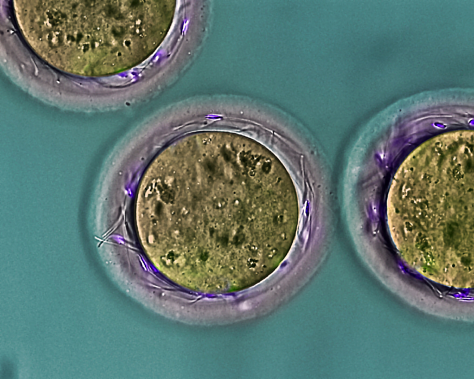 Investigadores de la UMU y el IMIB descubren una proteína del espermatozoide esencial para que ocurra la fecundación