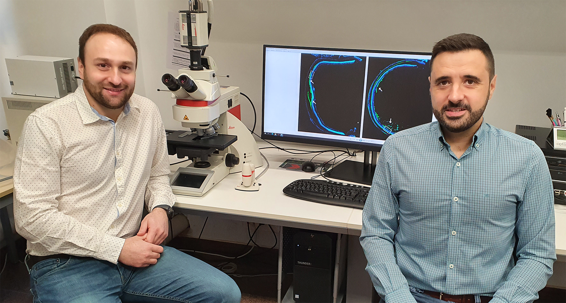 Investigadores de la UMU señalan los posibles beneficios del trasplante de células madre en pacientes con patologías retinianas